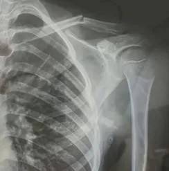 赤峰市教育局介入<strong></p>
<p>贵州茅台股票分析</strong>，家长称：孩子拨弄开关被另一班班主任打伤
