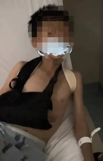 赤峰市教育局介入<strong></p>
<p>贵州茅台股票分析</strong>，家长称：孩子拨弄开关被另一班班主任打伤