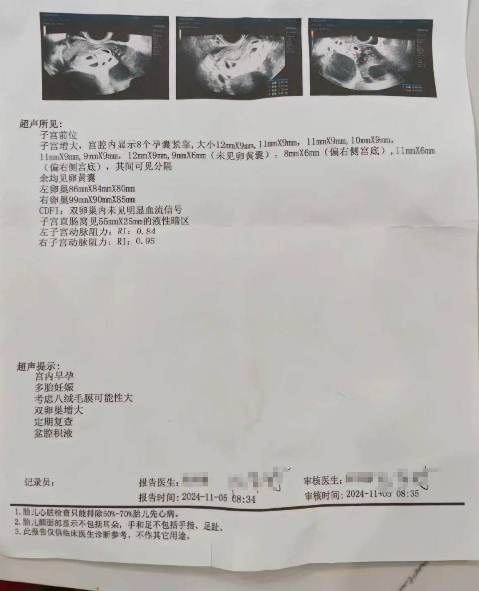 怀上9胞胎女子今日进行减胎手术：分两次进行<strong></p>
<p>IBOX</strong>，第一次减去四个胚胎，第二次减去三个