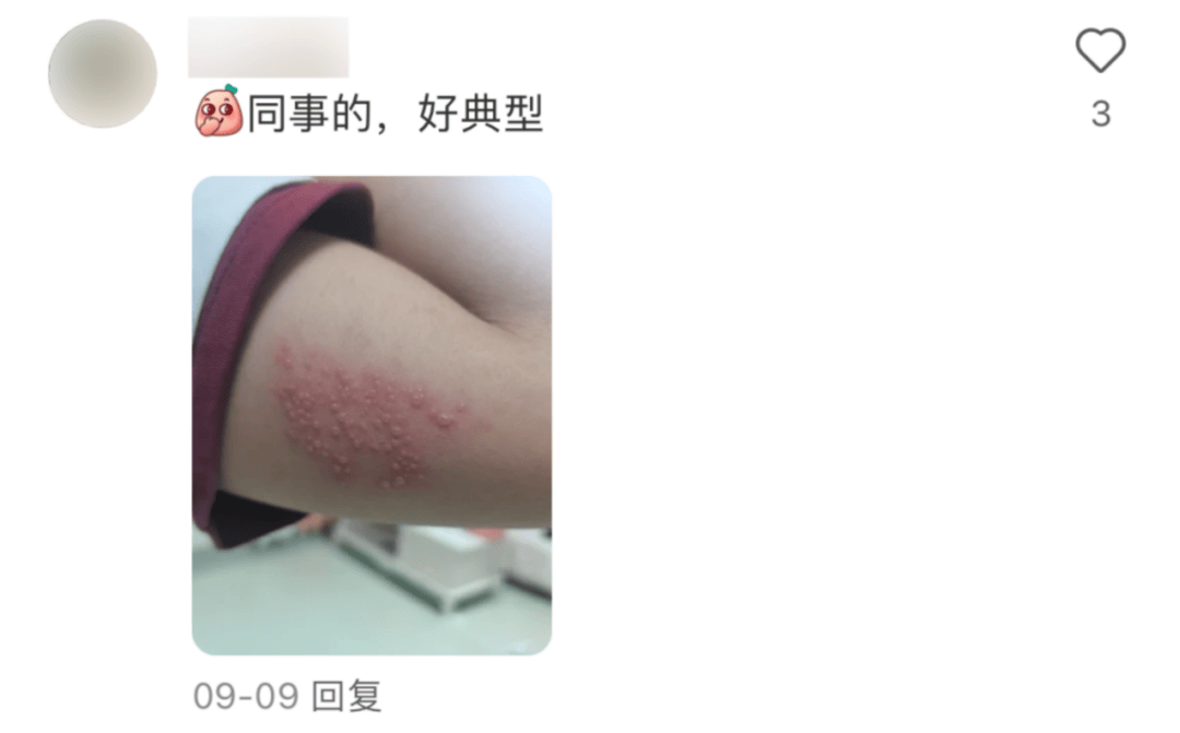 一旦感染终身携带<strong></p>
<p>IBOX</strong>！深圳疾控提醒：这4类人要注意