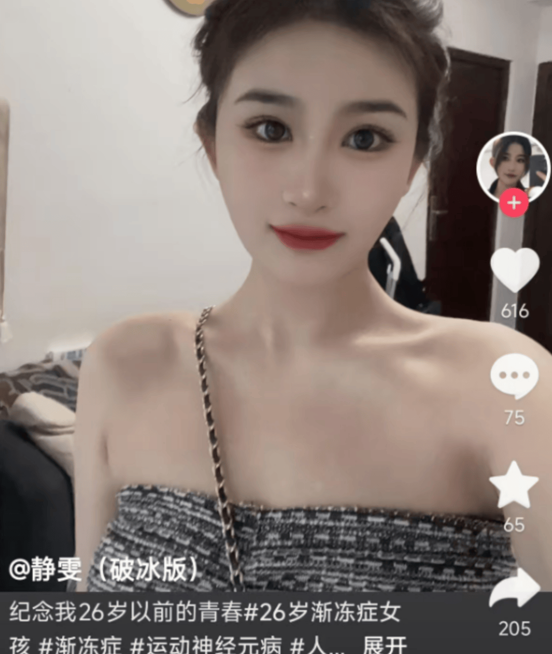 26岁渐冻症女孩去世<strong></p>
<p>安币交易所下载地址</strong>，生前曾向蔡磊求助，确诊仅1年
