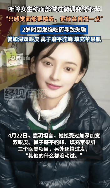 “美院聋哑女生因长相太完美”登热搜第一<strong></p>
<p>柬埔寨</strong>，本人承认微调：不太上镜，比照片视频好看