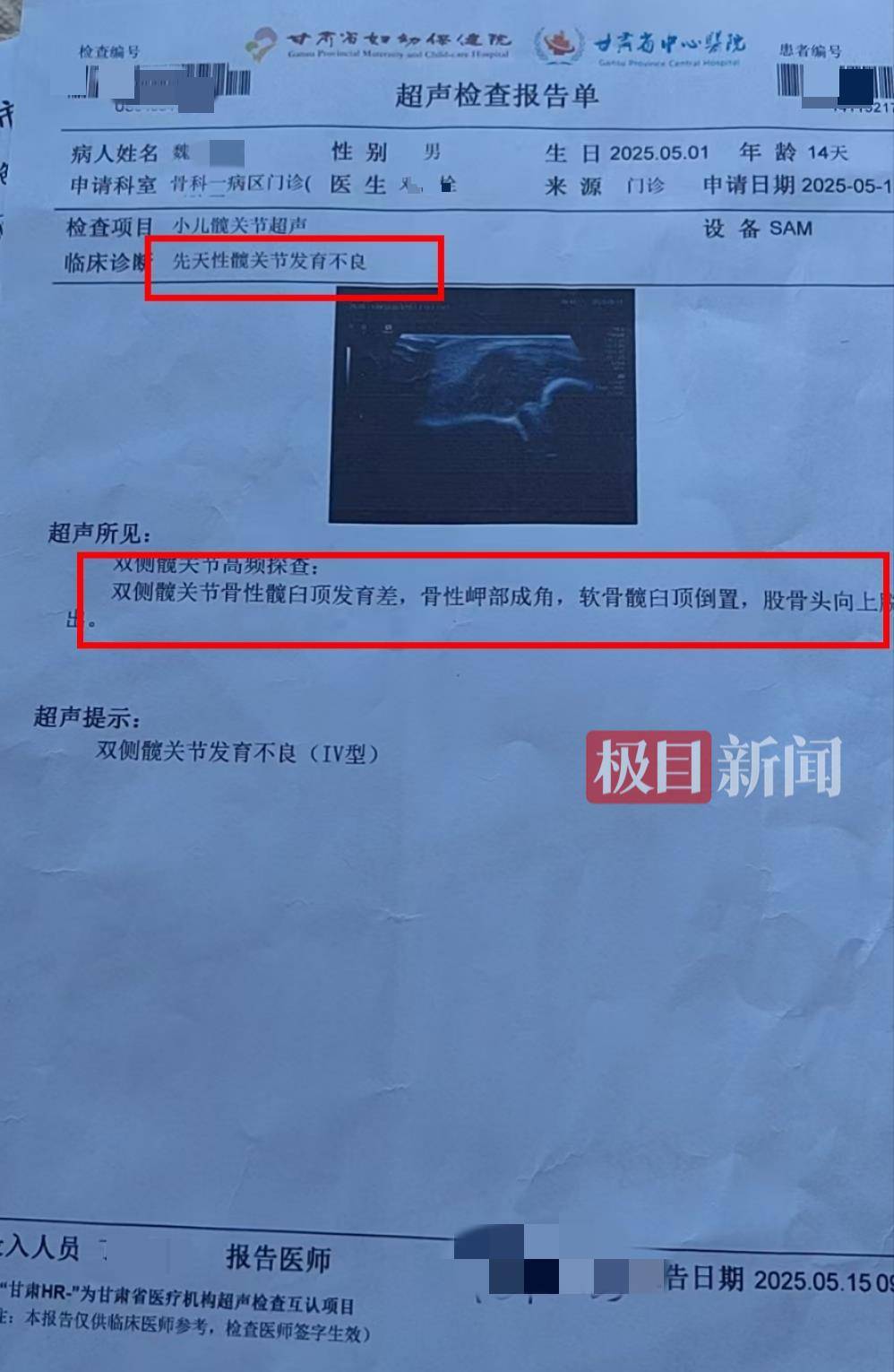 二胎出生查出先天性病症或落下残疾<strong></p>
<p>格力</strong>，残疾父母称医院产检漏检、未尽告知义务，医院及医调委回应