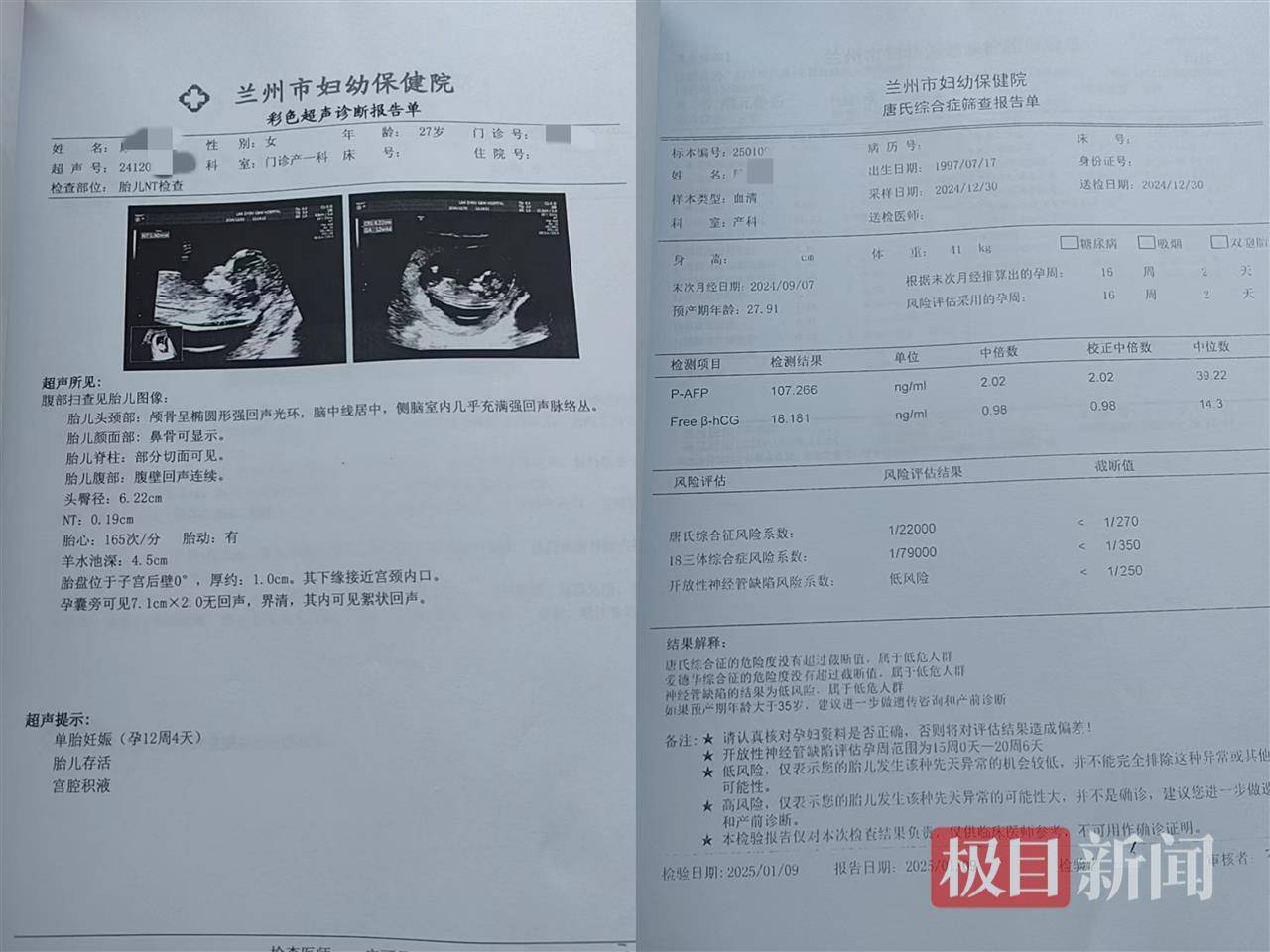 二胎出生查出先天性病症或落下残疾<strong></p>
<p>格力</strong>，残疾父母称医院产检漏检、未尽告知义务，医院及医调委回应