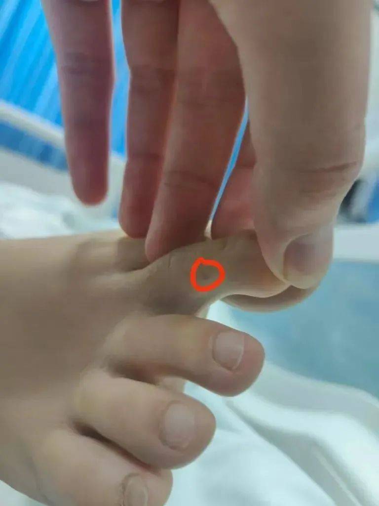 紧急转院仍无力回天<strong></p>
<p>格力</strong>！三亚蛇咬事件暴露旅游安全漏洞