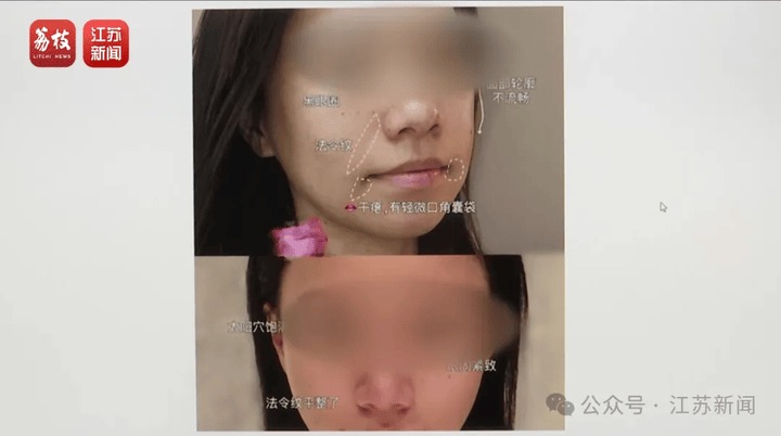 打一针“返老还童”的童颜针卖了30亿<strong></p>
<p>稳定币usdt</strong>，真的有效吗？