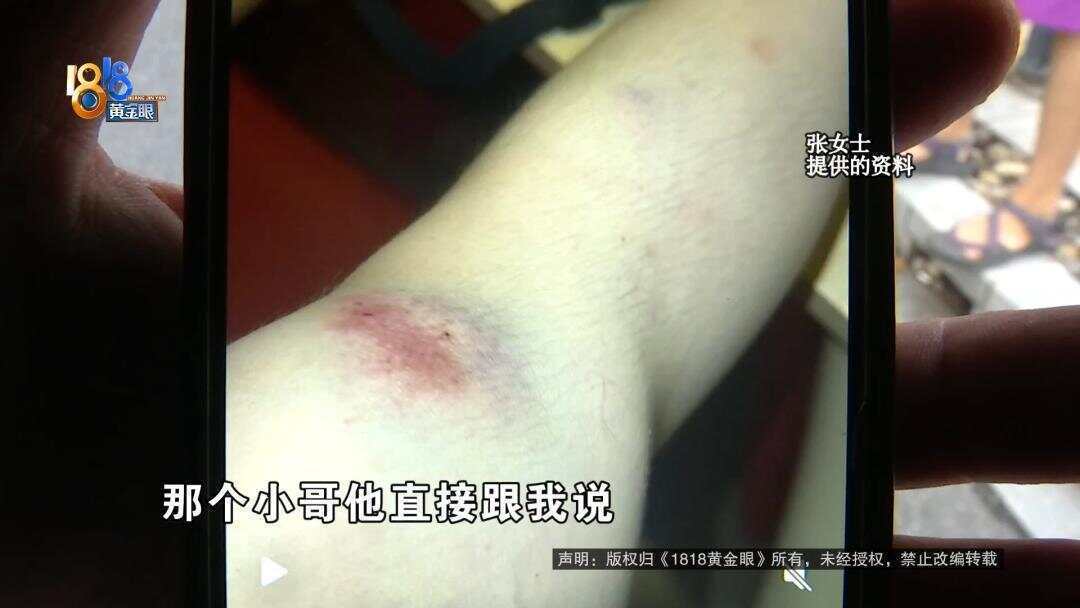 女子下班回家被外卖骑手撞伤 外卖小哥:<strong></p>
<p>usdt啥意思</strong>我只有三块钱