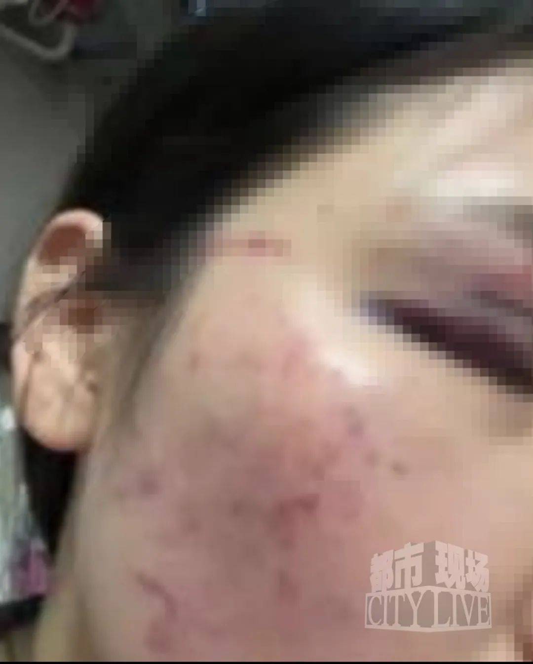 湖南衡阳29岁女子疑被男友施暴后从25楼跳下身亡 男友徐某此前还刺激说：“你放心<strong></p>
<p>币圈行情</strong>，她不会去死的”