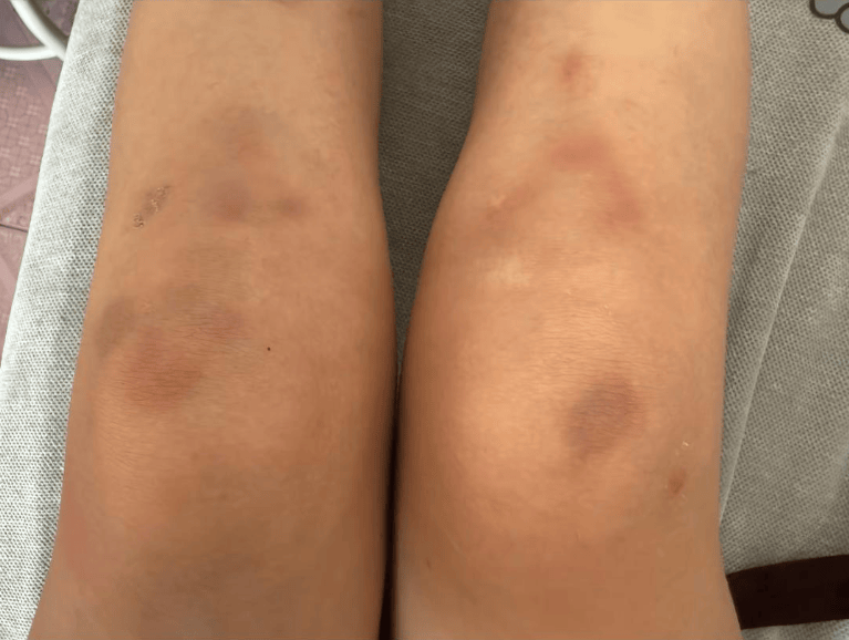 女子自称因工资问题被老板锁办公室里打 警方:双方已到派出所<strong></p>
<p>加密数字货币</strong>,是否打人还在调查