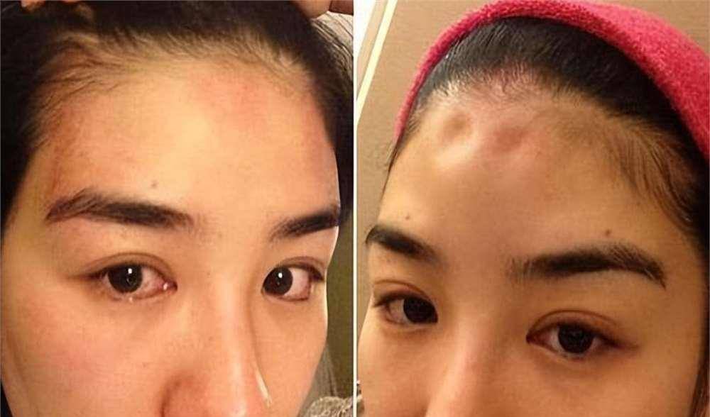 罗霖被家暴17年<strong></p>
<p>加密数字货币</strong>,蓝洁瑛遭性侵暴力还被围观!女明星的暴力事件还有很多