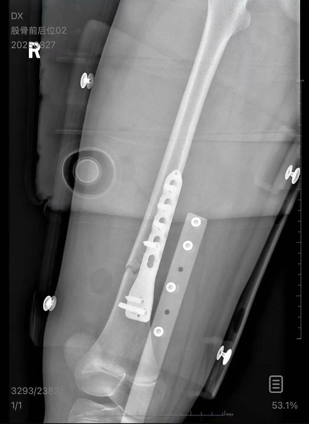 男子火车上铺跌落砸断10岁女孩腿骨<strong></p>
<p>加密货币</strong>,回应“失联”称失业讨薪中