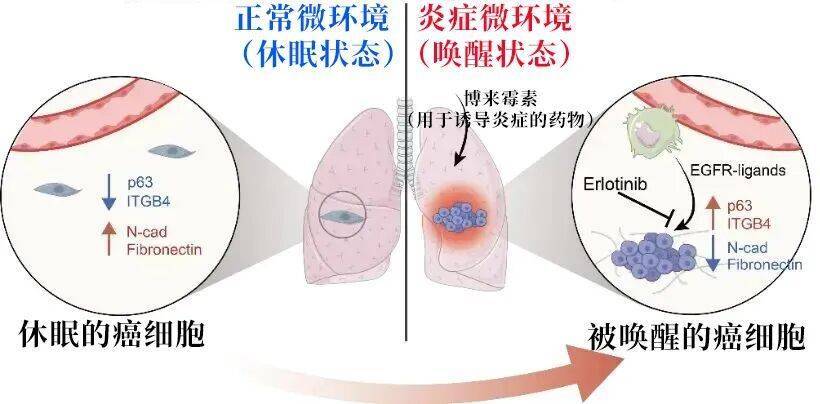 长期炎症会“唤醒”癌细胞<strong></p>
<p>加密货币</strong>!这份抗炎指南每个人都该看看