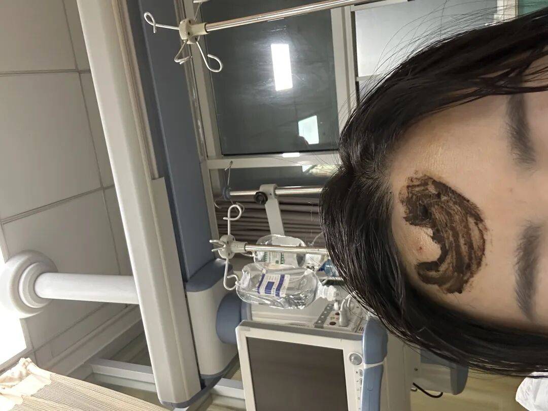 4名游客景区内遭马蜂袭击<strong></p>
<p>抹茶交易所</strong>,旅游度假区:是森林公园不卖门票,蜇伤先就医后提供证据投诉