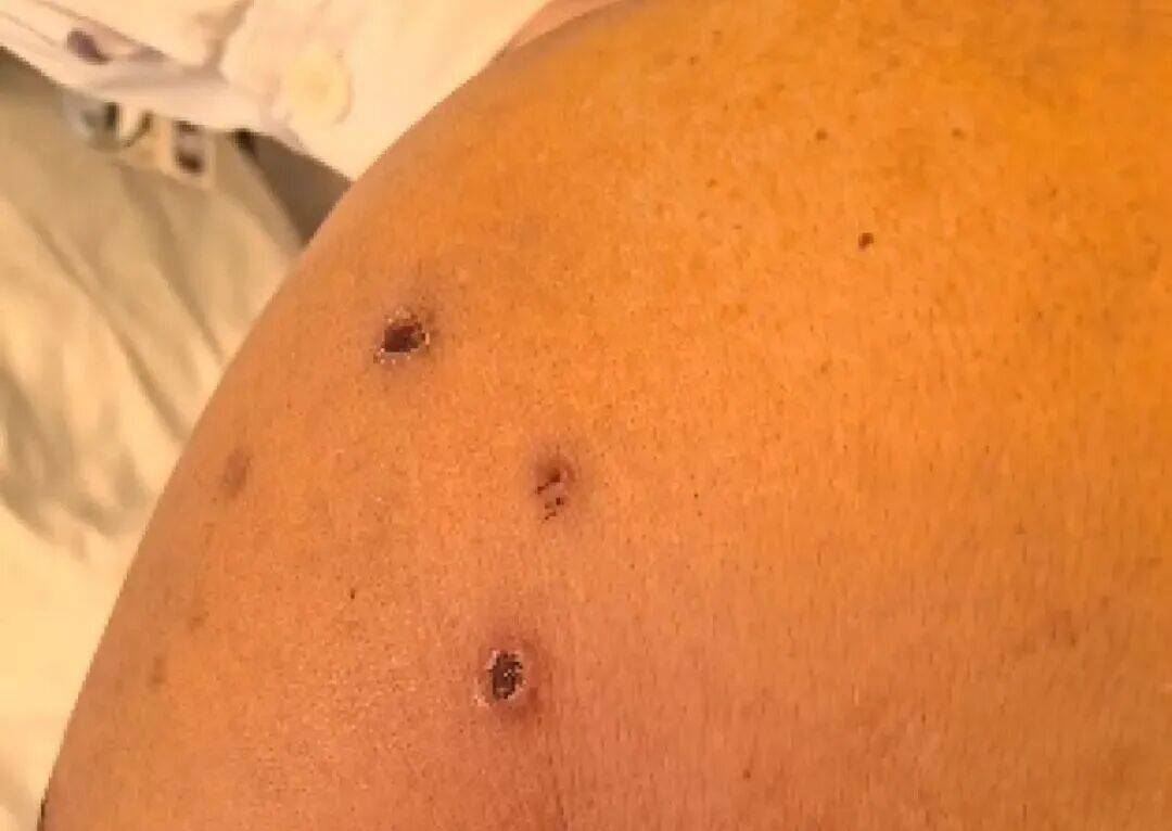 深圳一市民突遭马蜂围袭!已进入高发期<strong></p>
<p>抹茶交易所</strong>,千万别招惹!