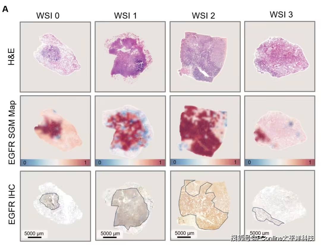 准确率高达 99%<strong></p>
<p>区块链</strong>!腾讯 AI 可预测肺癌基因突变