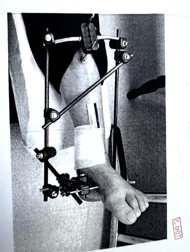 男子停车场随地小便被制止<strong></p>
<p>沥青现货价格</strong>，恼羞成怒飞踹管理员致自己骨折，索赔18万余元，法院判了