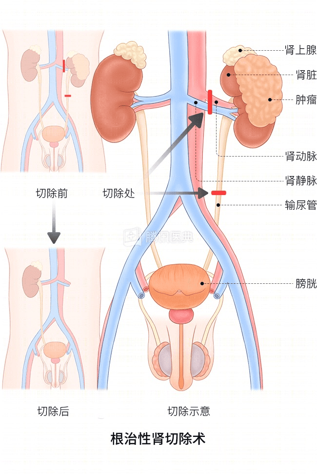 “感觉天塌了”！深圳女孩5岁患癌<strong></p>
<p>期货和现货价格</strong>，爸妈决定：为她冻存卵巢组织